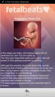 YOUR BABY'S HEARTBEAT ANYTIME!