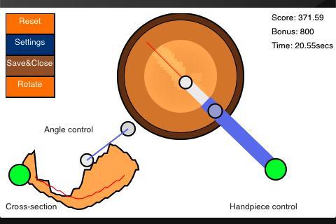 cataractDroid Free