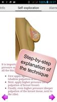 Breast Self-Examination