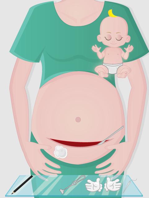 Birth Surgery Hospital Doctor