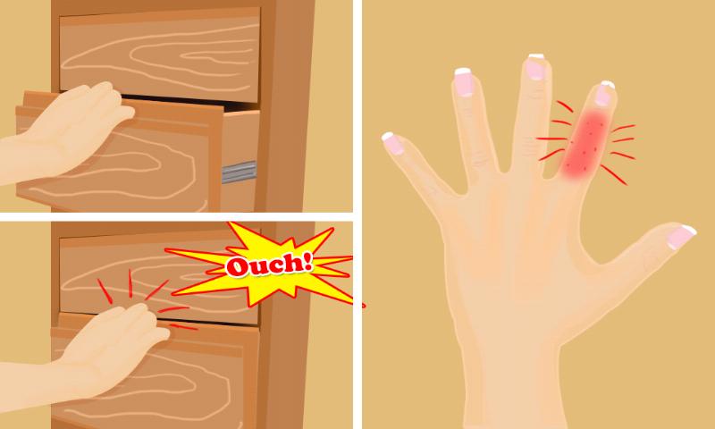 Finger Surgery Doctor